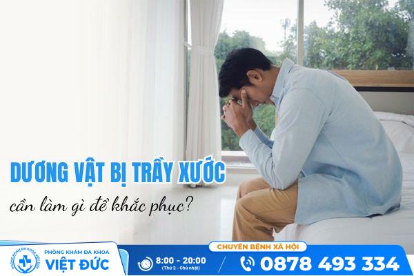 Nguyên nhân dương vật bị trầy xước là gì? 8 Dương vật bị trầy xước phải làm sao để khắc phục?