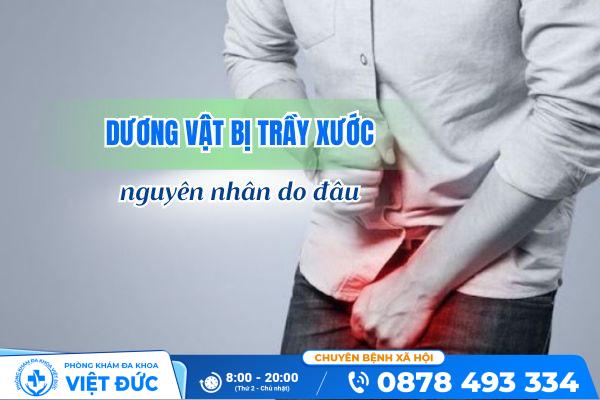 Nguyên nhân dương vật bị trầy xước là gì? 2 Nguyên nhân dương vật bị trầy xước là gì?