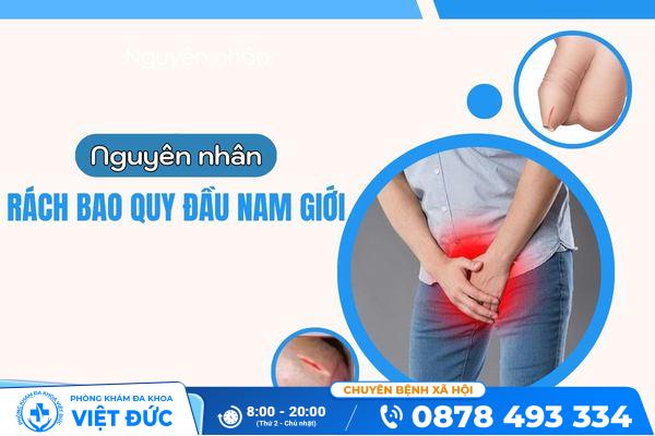 Nguyên nhân gây rách bao quy đầu và hướng dẫn cách xử lý 10 Nguyên nhân gây rách bao quy đầu