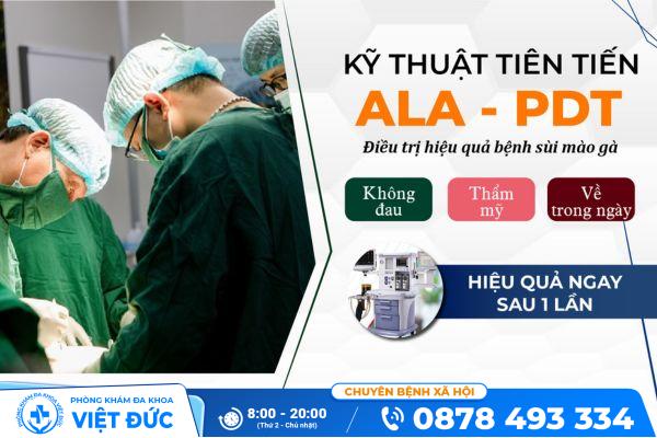 Tìm hiểu hỗ trợ điều trị sùi mào gà bằng phương pháp ALA - PDT 13 Phương pháp hỗ trợ điều trị sùi mào gà bằng ALA - PDT