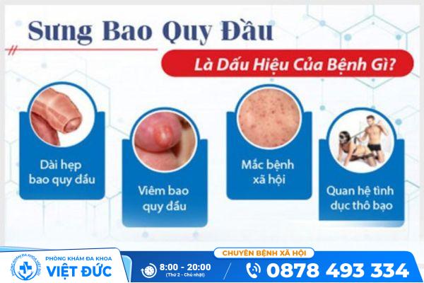 Tình trạng sưng bao quy đầu ở nam giới cần hết sức cảnh giác 4 Tình trạng sưng bao quy đầu ở nam giới